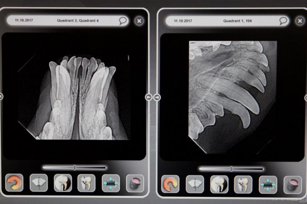dental-xray